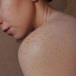 Hautpflege | Mai ist Monat der Hautgesundheit